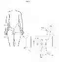 Fig. 03 - Devices and methods for wearable injection guides