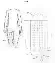 Fig. 45 - Devices and methods for wearable injection guides