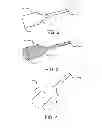 Fig. 03 - Guide extension catheters and methods for manufacturing the same
