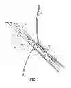 Fig. 07 - Guide extension catheters and methods for manufacturing the same
