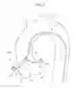 Fig. 07 - Catheter