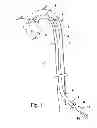 Fig. 02 - Push device for the axial insertion of an elongate, flexible body