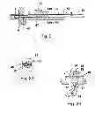 Fig. 09 - Push device for the axial insertion of an elongate, flexible body