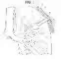 Fig. 02 - Method for treatment of chronic obstructive pulmonary disease