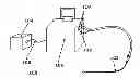 Fig. 01 - Therapeutic cryoablation system