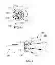 Fig. 04 - Adjustable length and/or exposure electrodes