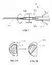 Fig. 06 - Adjustable length and/or exposure electrodes