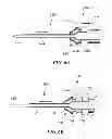 Fig. 07 - Adjustable length and/or exposure electrodes