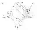 Fig. 01 - Methods for creating a channel through an occlusion within a body vessel