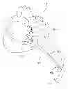 Fig. 01 - CARDIAC ABLATION DEVICES AND METHODS