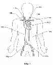 Fig. 02 - Expandable trans-septal sheath