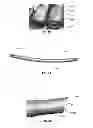 Fig. 07 - Surgical instruments and methods of use
