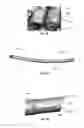 Fig. 07 - SOFT TISSUE FIXATION DEVICES AND METHODS