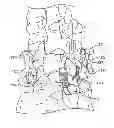 Fig. 01 - SURGICAL TETHER APPARATUS AND METHODS OF USE