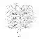 Fig. 02 - System and method for correction of a spinal disorder