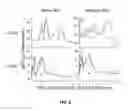 Fig. 09 - Method and device to restore and/or improve nervous system functions by modifying specific nervous system pathways