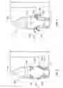 Fig. 04 - Cardiac stimulation system