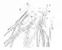 Fig. 01 - Stent and stent-graft designs