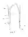 Fig. 06 - Stent and stent-graft designs