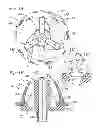 Fig. 02 - Holders for prosthetic heart valves