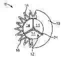 Fig. 01 - Transcatheter mitral valve prosthesis