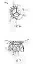 Fig. 09 - Transcatheter mitral valve prosthesis