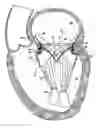 Fig. 01 - Methods for replacing a cardiac valve