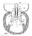 Fig. 02 - Methods for replacing a cardiac valve