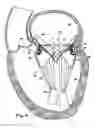 Fig. 06 - Methods for replacing a cardiac valve