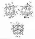 Fig. 08 - Methods for replacing a cardiac valve