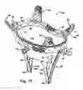 Fig. 09 - Methods for replacing a cardiac valve