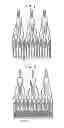 Fig. 02 - Stent-valves for valve replacement and associated methods and systems for surgery