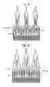 Fig. 03 - Stent-valves for valve replacement and associated methods and systems for surgery