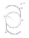 Fig. 01 - Intraocular lens and manufacturing method thereof