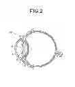 Fig. 03 - Intraocular lens and manufacturing method thereof