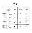 Fig. 06 - Intraocular lens and manufacturing method thereof