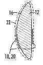 Fig. 01 - Breast implant assembly