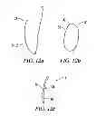 Fig. 03 - Breast implant assembly