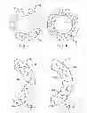 Fig. 03 - HYBRID BREAST IMPLANT AND TISSUE EXPANDER, METHODS OF MAKING AND USE OF SAME