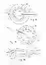 Fig. 08 - HYBRID BREAST IMPLANT AND TISSUE EXPANDER, METHODS OF MAKING AND USE OF SAME