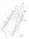 Fig. 09 - Septal implant