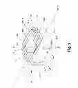 Fig. 02 - Intervertebral implant devices for supporting vertebrae and devices and methods for insertion thereof