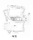Fig. 06 - Pivotal lateral cage and method of insertion