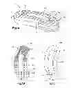 Fig. 02 - Allograft intervertebral implant and method of manufacturing the same