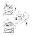 Fig. 07 - Allograft intervertebral implant and method of manufacturing the same