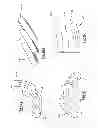 Fig. 09 - Allograft intervertebral implant and method of manufacturing the same