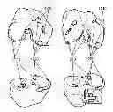 Fig. 01 - Patient-adapted and improved articular implants, designs and related guide tools