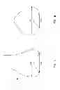 Fig. 02 - Patient-adapted and improved articular implants, designs and related guide tools