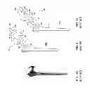 Fig. 07 - Patient-adapted and improved articular implants, designs and related guide tools