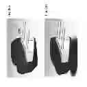 Fig. 124 - Patient-adapted and improved articular implants, designs and related guide tools